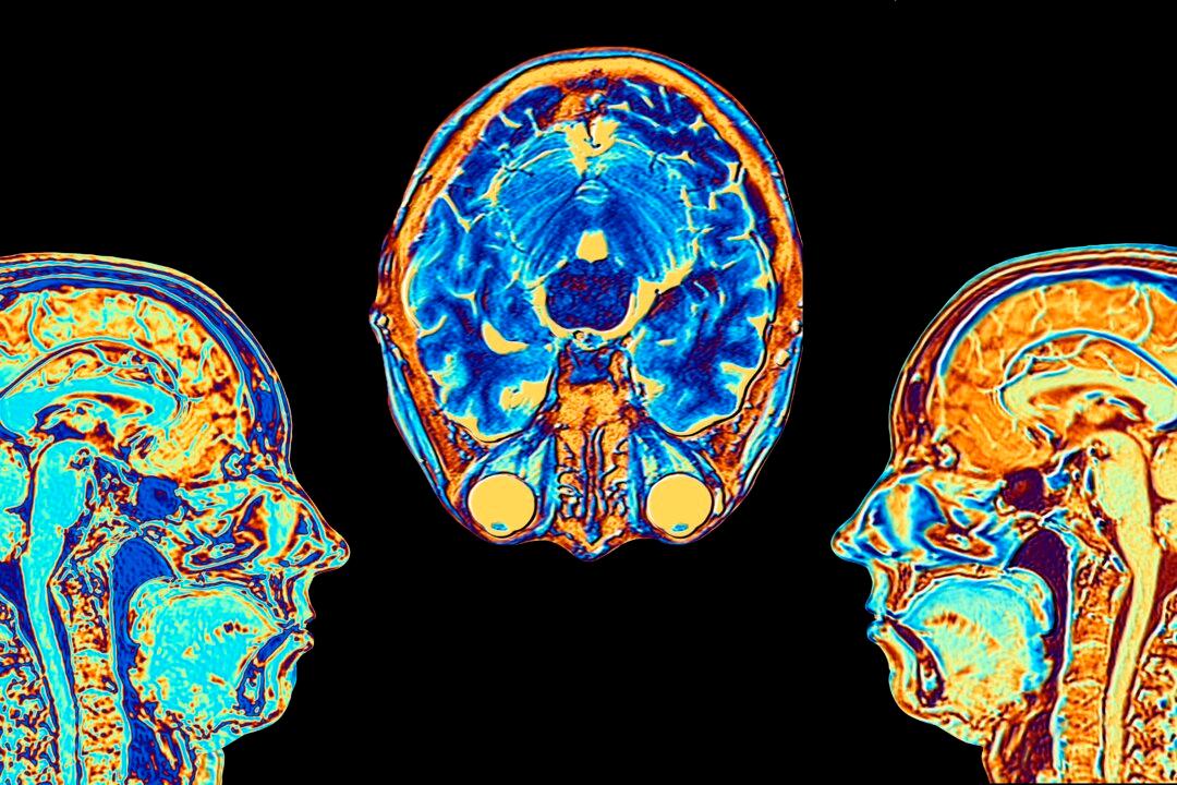 FDA Approves Brain Tumor Treatment by Drugmaker Servier