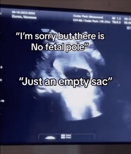 Ms. Duran's pregnancy was misdiagnosed as an empty sac, and it was suggested she go for a D&C abortion procedure. (Courtesy of <a href="https://www.instagram.com/msvanessaduran/">@msvanessaduran</a>)