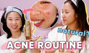 Acne-Prone Routine With My Sister | Gen Z vs. Millennial Skincare