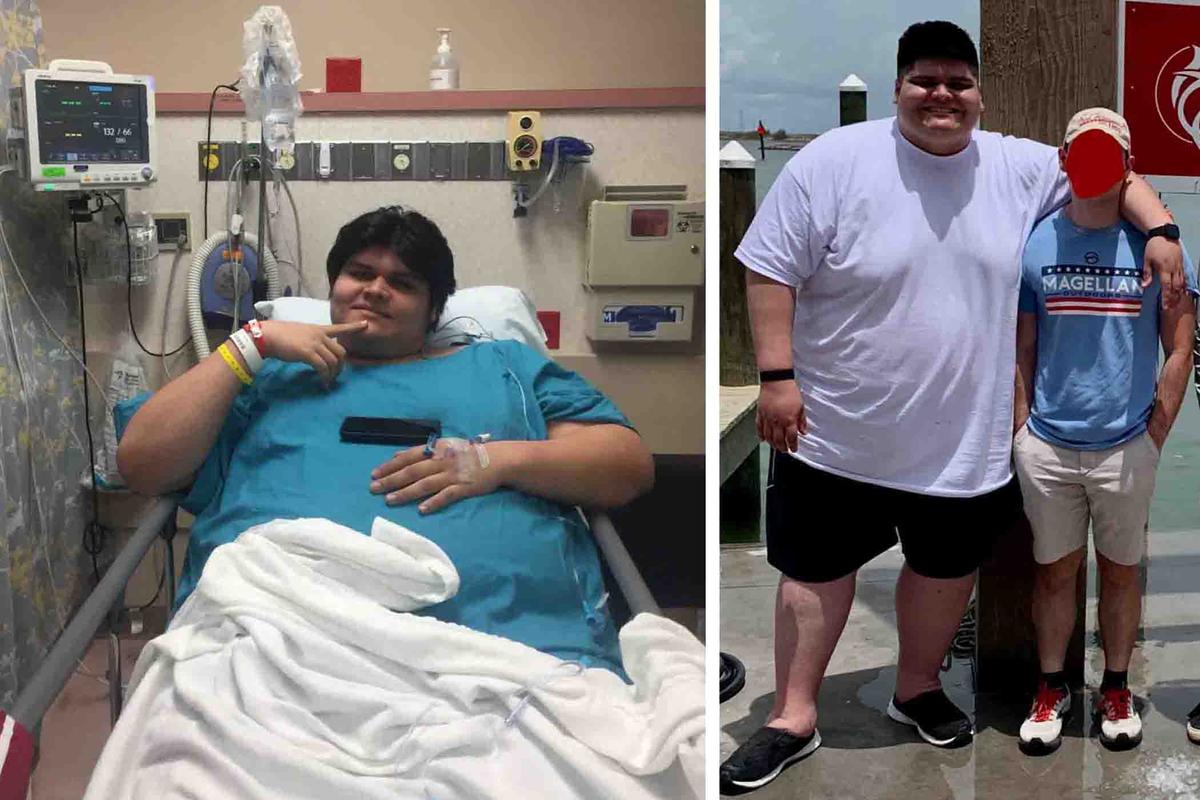 (Left) Freddy hospitalized after sustaining a broken ankle in 2019; (Right) Freddy around the time when his weight peaked at 615 pounds. (Courtesy of <a href="https://www.instagram.com/bigbodybigdog/">Freddy Rojo</a>)
