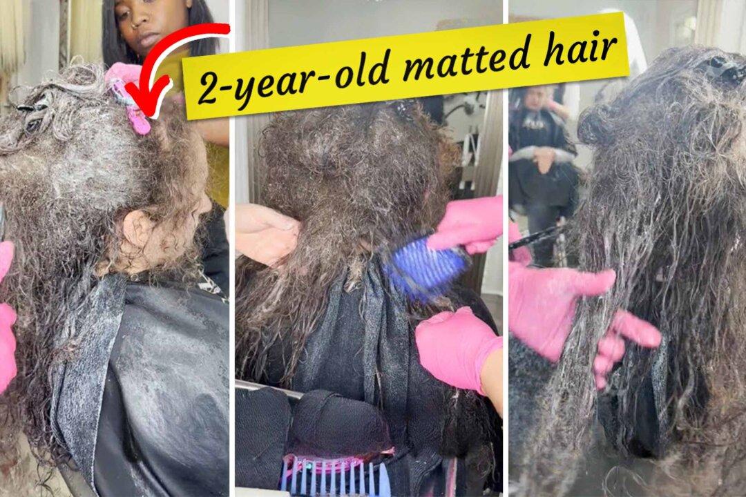 Woman Is Freed From ‘Permanent Headache’ After Salon Spends 10 Hours Detangling Her Matted Hair—See the Amazing Result