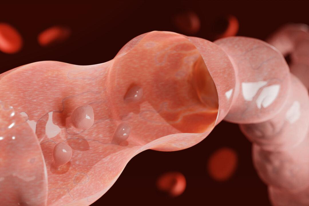 10 Early Signs of Colorectal Cancer and Healthy Habits to Reduce Risk