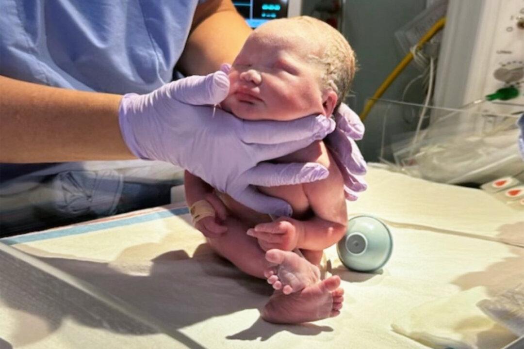 Baby Born Without Eyes and With Half Her Brain Disconnected Baffles Doctors, Hits All Her Milestones