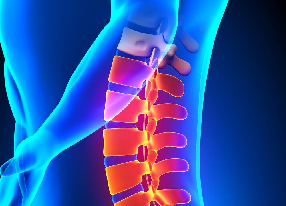 Chiropractic Care May Reduce Need for Future Back Surgeries: Study