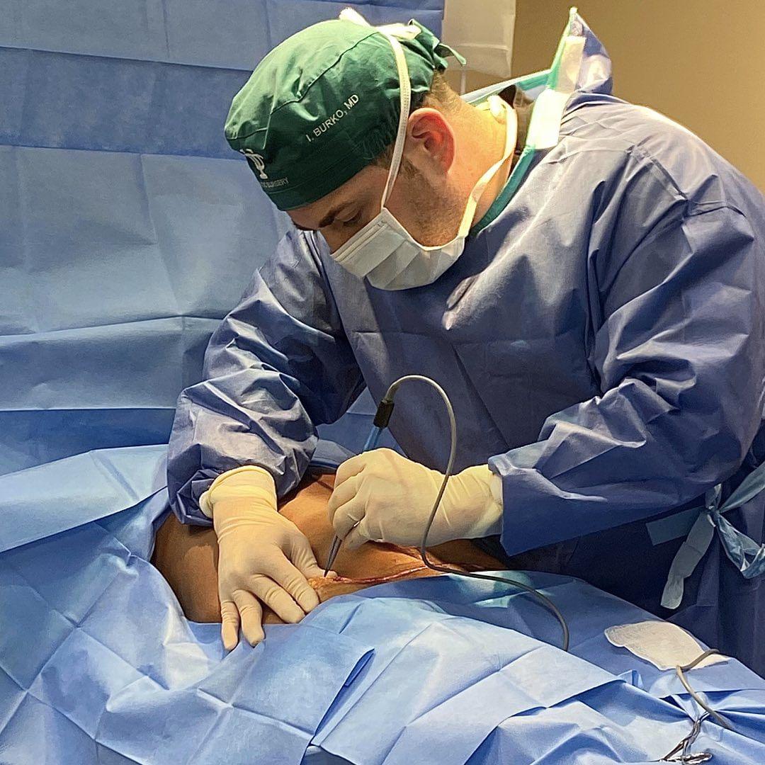 Dr. Burko conducts a Tummy Tuck case. (SY Aesthetics)