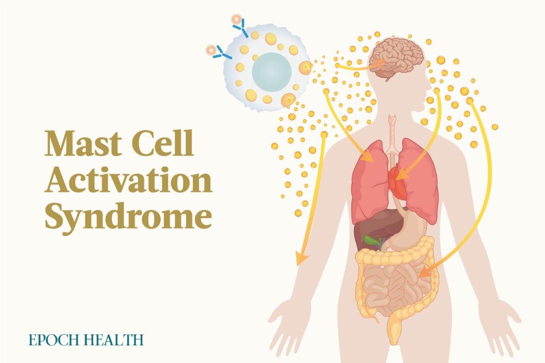 Mast Cell Activation Syndrome: Symptoms, Causes, Treatments, and Natural Approaches