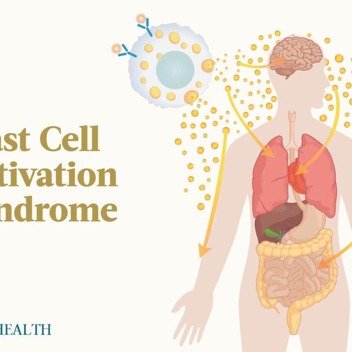 The Essential Guide to Mast Cell Activation Syndrome: Symptoms, Causes, Treatments, and Natural Approaches