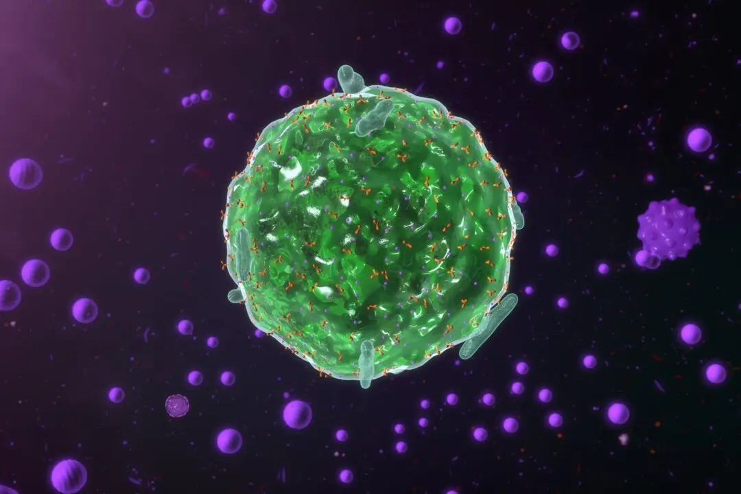 Demystifying Mast Cell Activation Syndrome