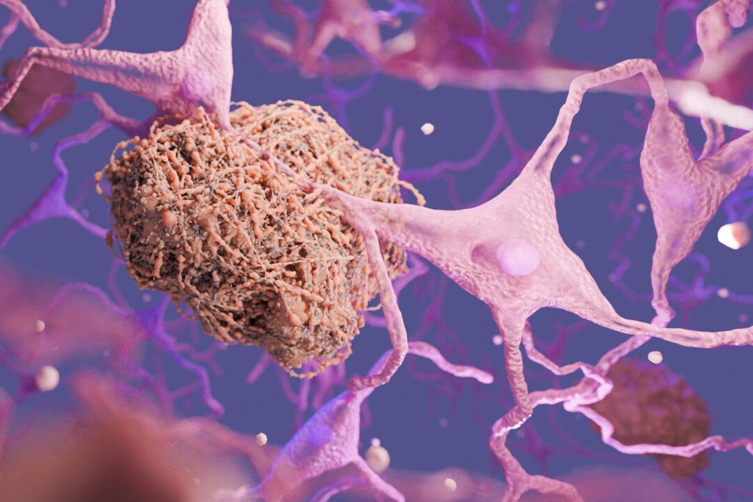 mRNA Vaccines Contain Prion Region, May Be Linked to Prion-Like Diseases