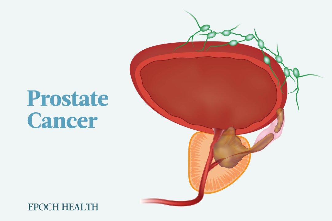 Prostate Cancer: Symptoms, Causes, Treatments, and Natural Approaches