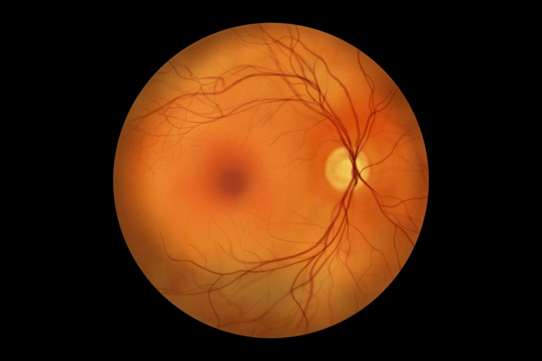 Macular Degeneration: Treatments Seek to Limit or Stop Vision Loss
