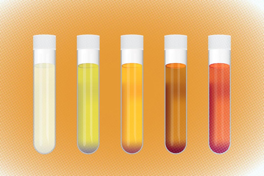 Urine Colors May Be Warning Signs of Diseases, Here’s How to Tell