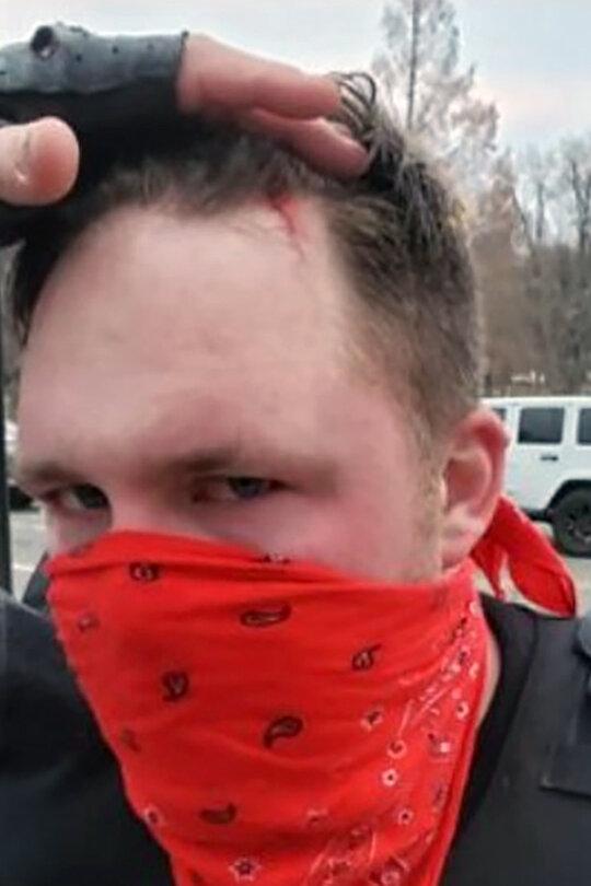 Ronald Colton McAbee shows the gash in his head from being struck by a police baton on Jan. 6, 2021. (Courtesy of Sarah McAbee)