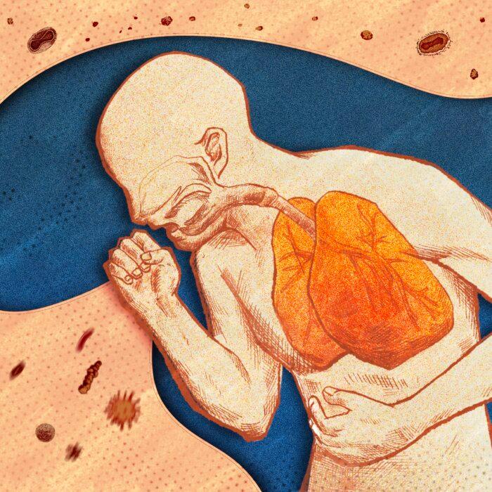 The Causes of Coughs, and How to Fix Them