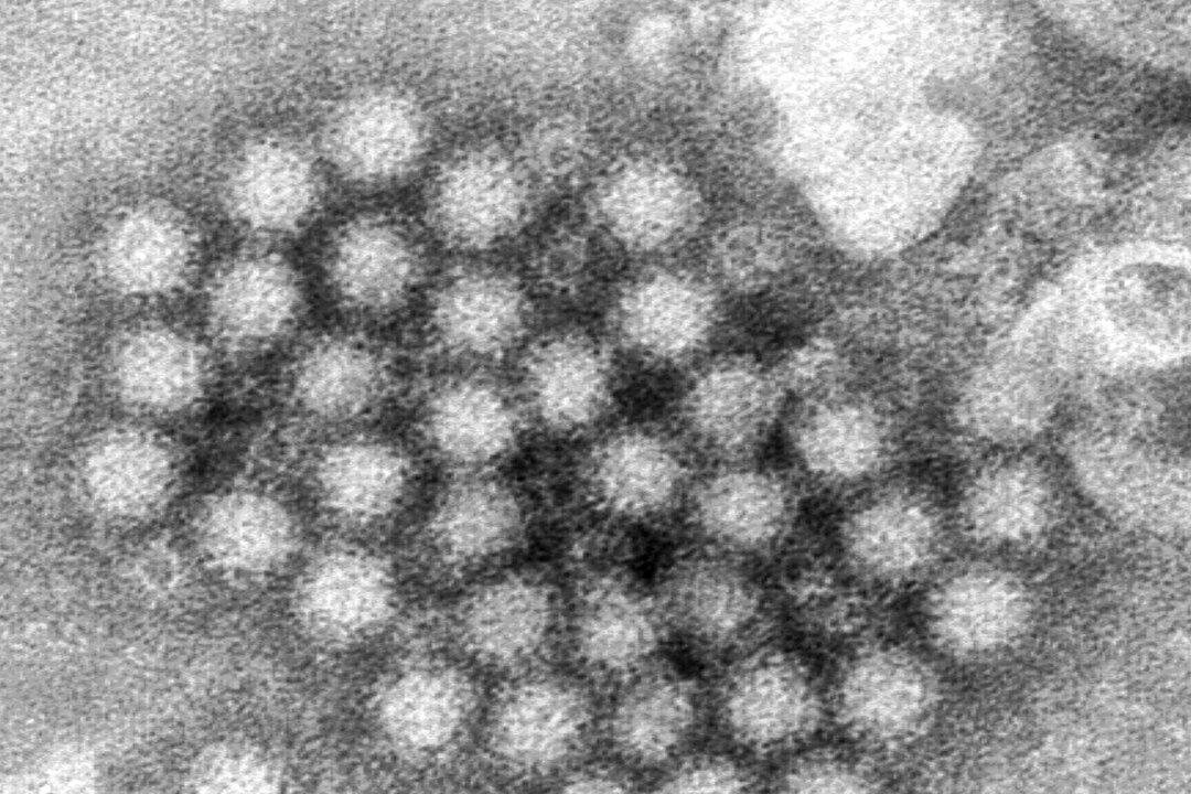 Norovirus Illnesses Are up in Some Places—Here’s What You Need to Know