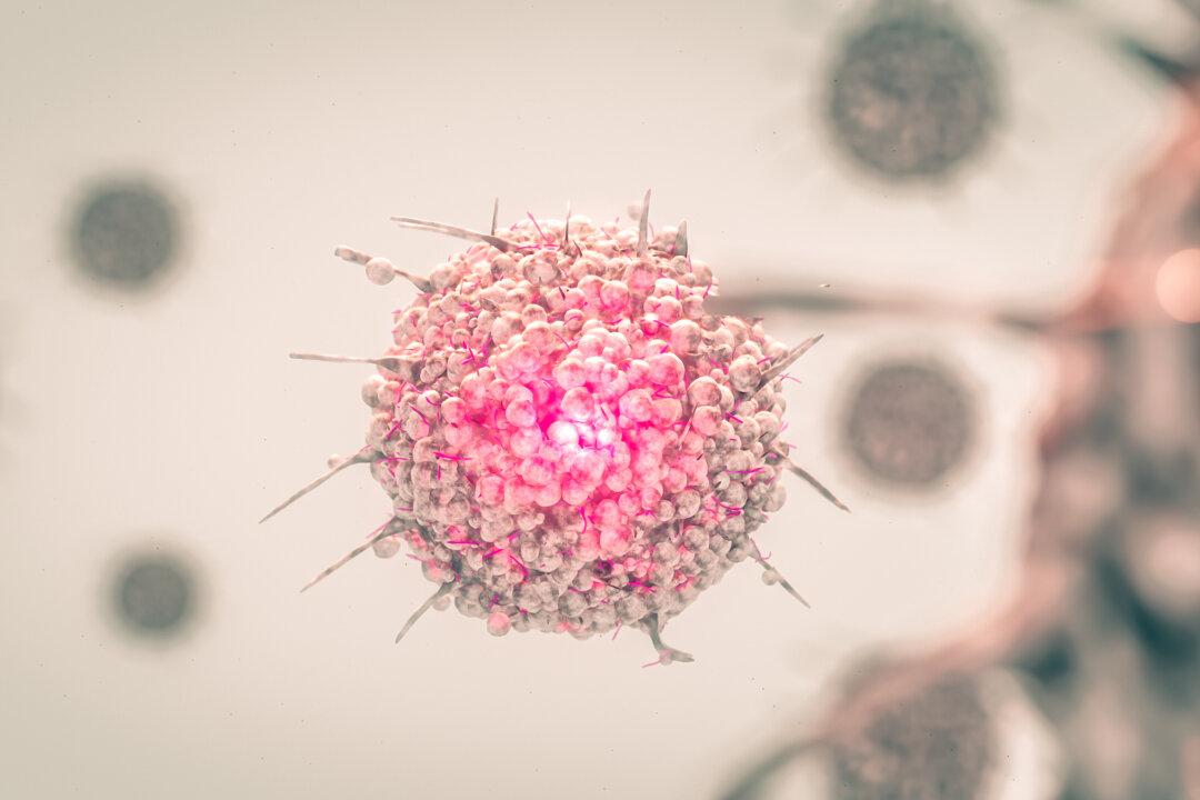 A Novel Theory on Breast Cancer and Exercise