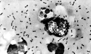 Health Officials: Man Dies From Bubonic Plague in New Mexico
