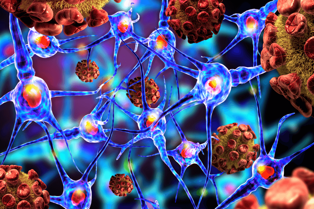 Rare Neurological Disorder Linked to COVID-19 Vaccination, Research Suggests