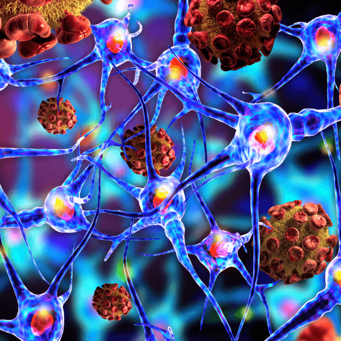 Rare Neurological Disorder Linked to COVID-19 Vaccination, Research Suggests