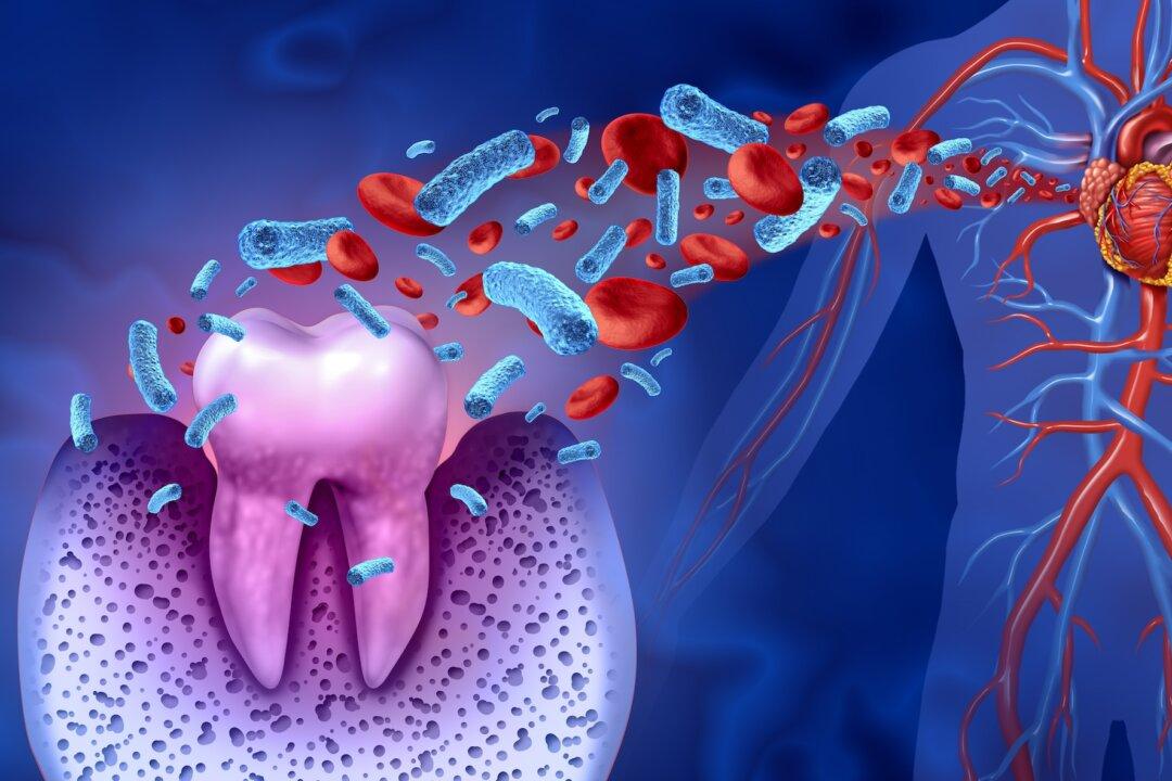 Treating Gum Disease May Prevent Return of Irregular Heartbeat: Study