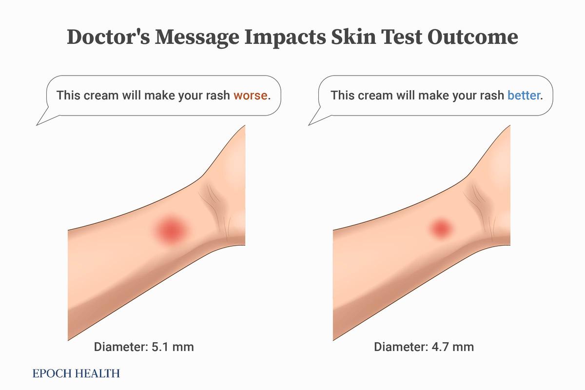 A doctor's message impacts the outcome of a histamine skin prick test. (The Epoch Times)