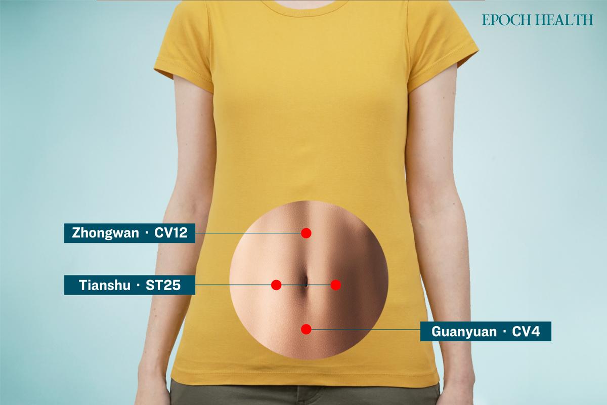 The locations of Zhongwan, Tianshu, and Guanyuan acupoints. (The Epoch Times)