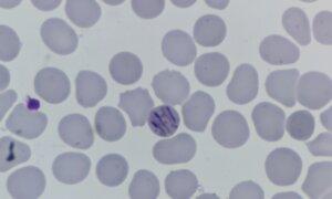 Southeastern Ontario Health Unit Probes 114 Cases of Parasitic Stomach Illness