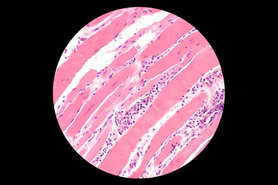 Increased Reports of Rare Autoimmune Disease, COVID-19 and Its Vaccine Contributed: Study