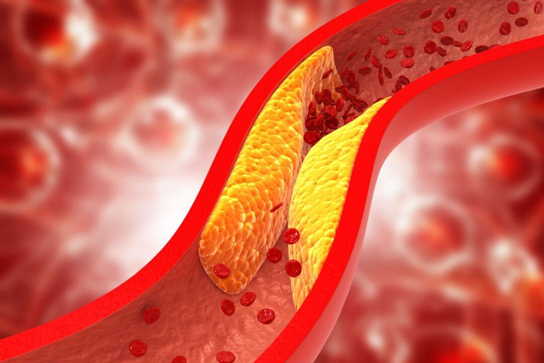Considering the Cholesterol Controversy