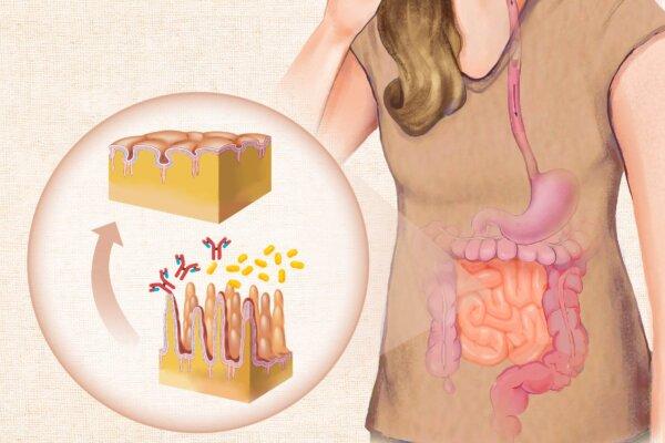 Celiac Disease: Symptoms, Causes, Treatments, and Natural Approaches