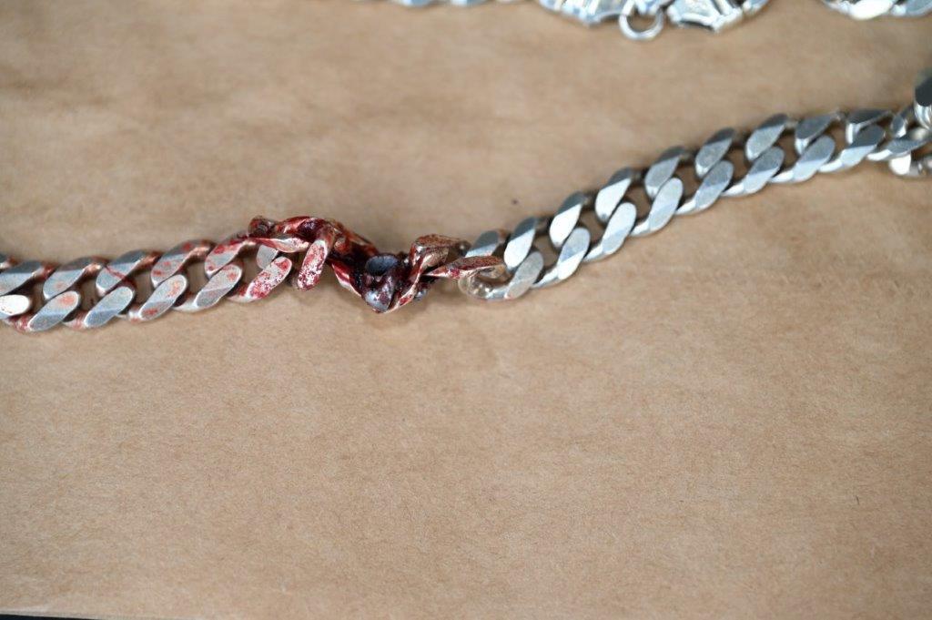 A neck chain with a bullet lodged in it likely saved the neck of its owner. (Courtesy of Commerce City Police Department)