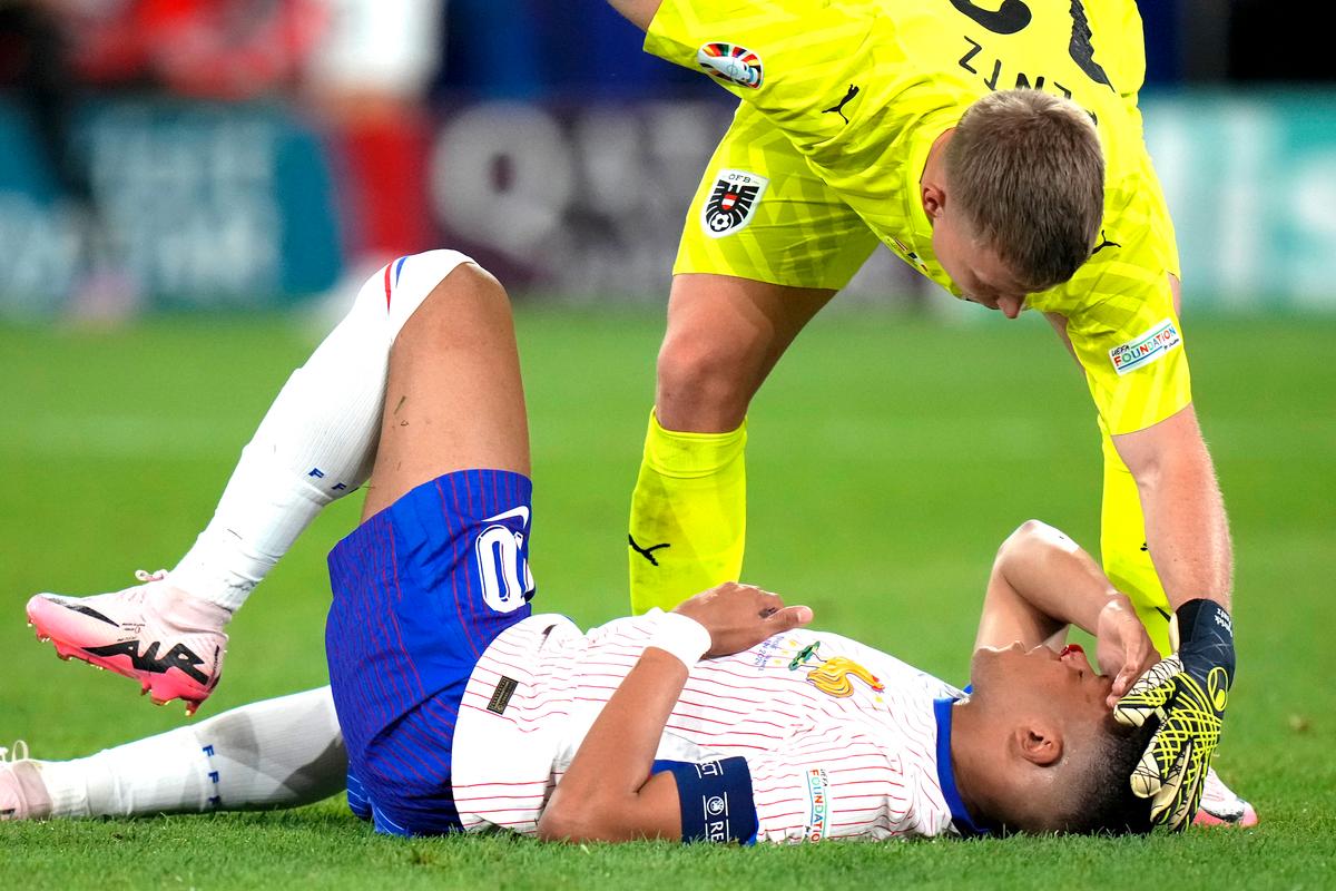 Mbappe Suffers Broken Nose During France’s Euros Win Over Austria