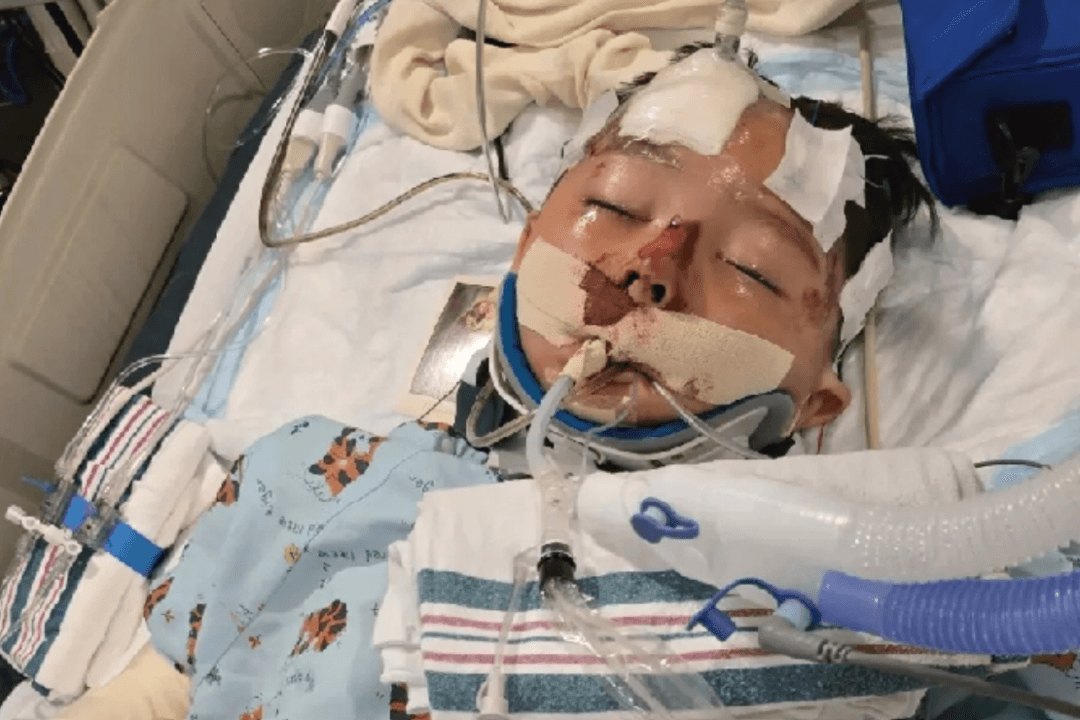 Report: Boy Injured in Orange County Hit-And-Run Declared Brain Dead