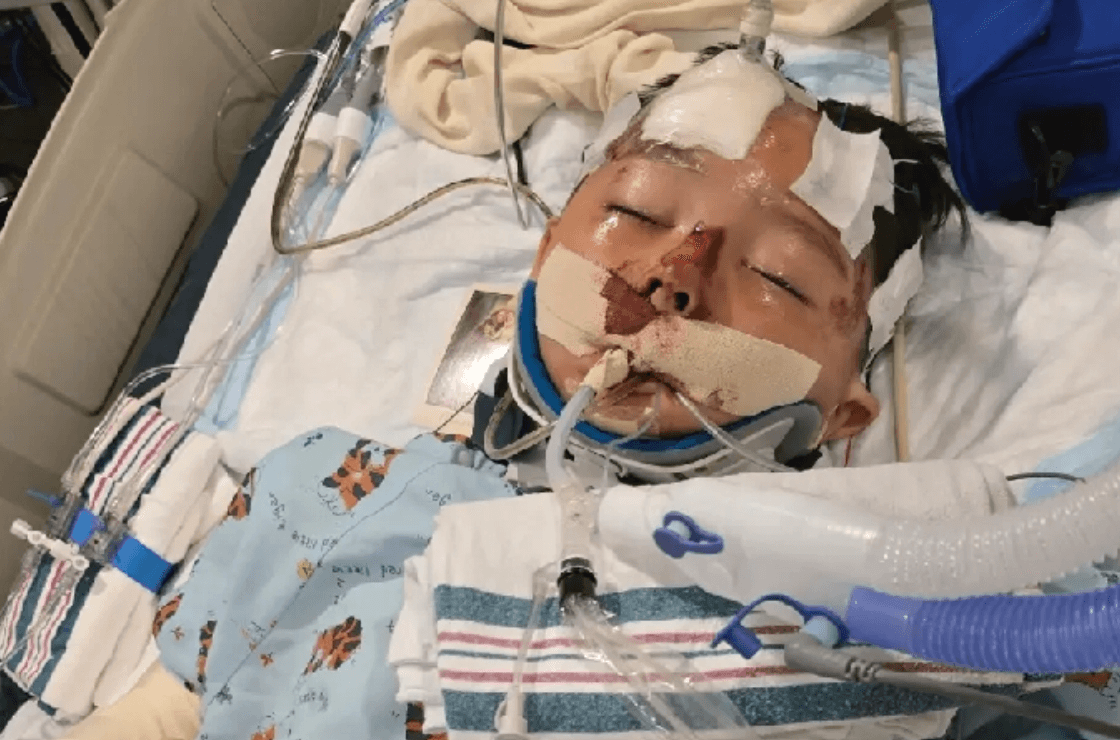 Report: Boy Injured in Orange County Hit-And-Run Declared Brain Dead