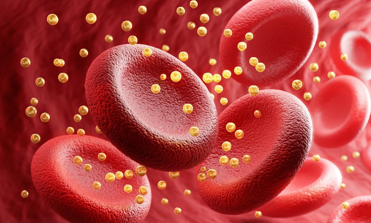 Study Challenges ‘Bad Cholesterol’ Label for LDL