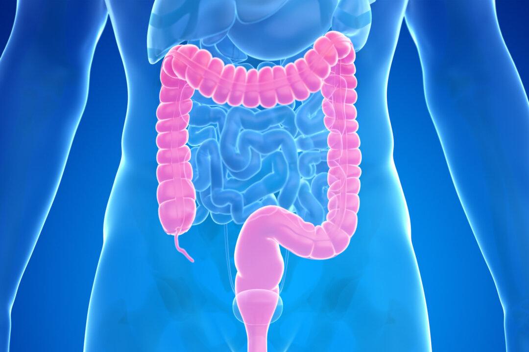 1st ‘Living’ Guideline for Managing Moderate-to-Severe Ulcerative Colitis Released