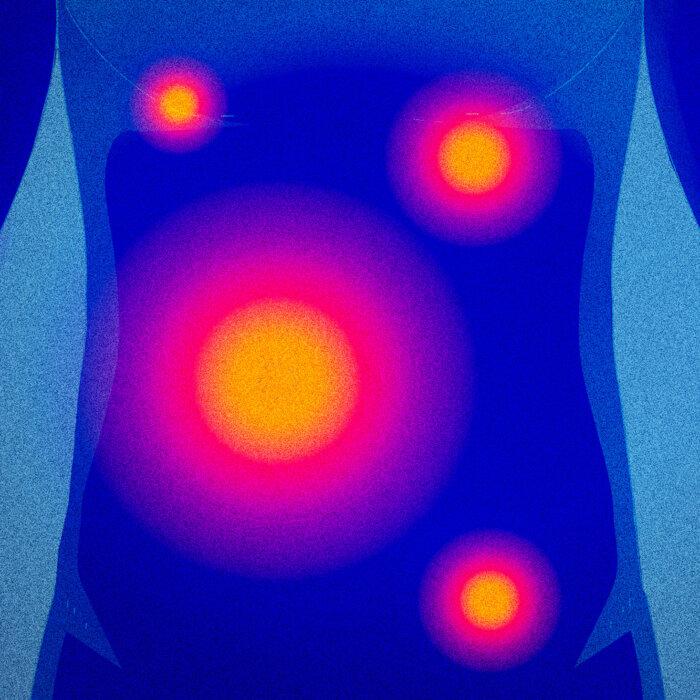 Inflammation: The Body’s ‘Fire’ Burns Threats, but Things Go Wrong When It Smolders