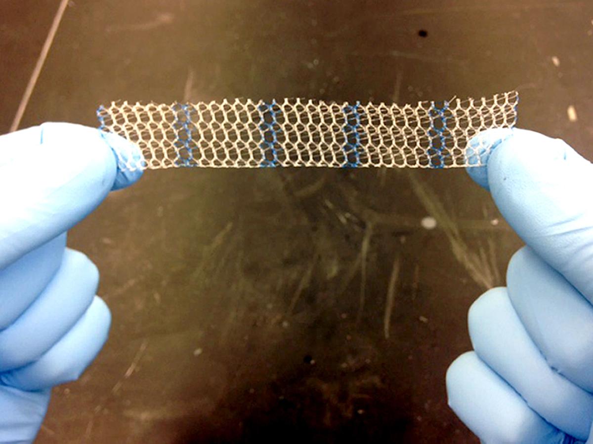 Women to Receive Payouts for Vaginal Mesh Damage