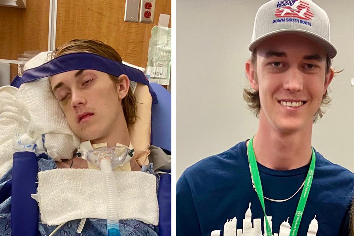 (Left) Davin in the hospital after his accident on Dec. 1, 2023; (Right) Davin before the accident. (Courtesy of Jennifer Rowland and David Rowland)