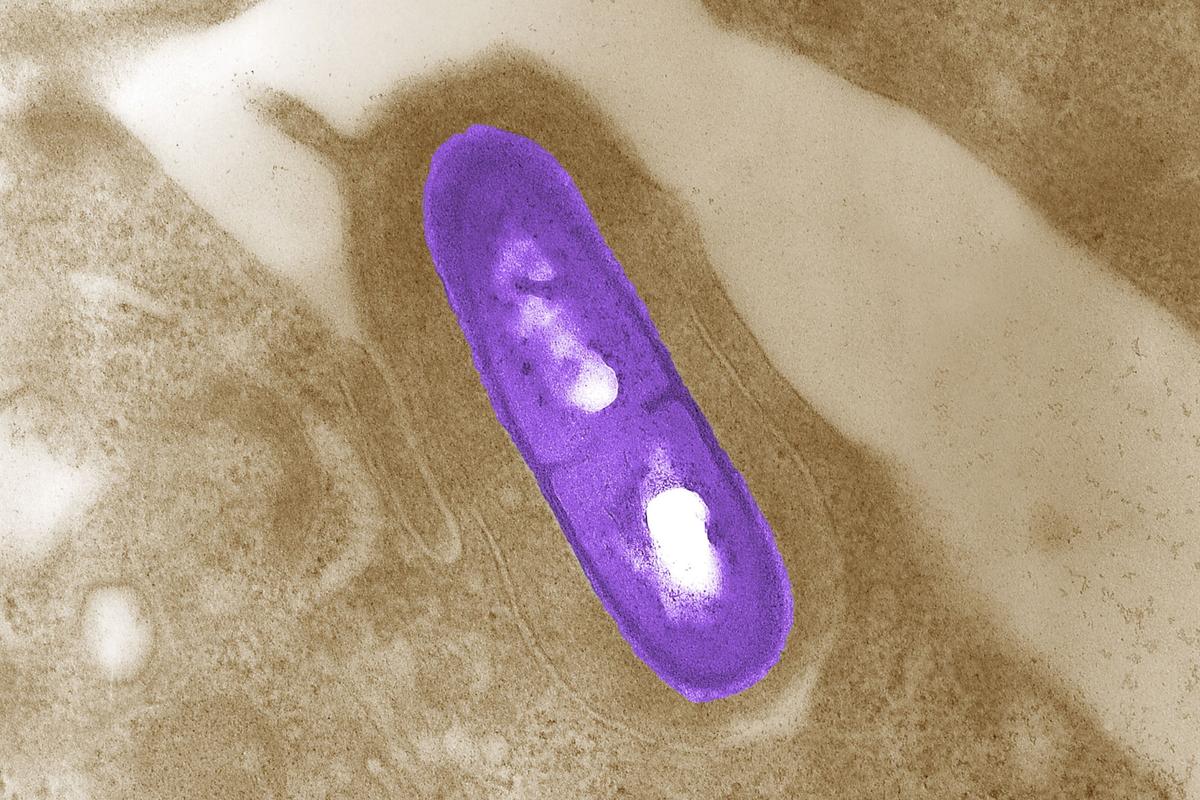 Death Toll From Multistate Listeria Outbreak Related to Deli Meats Rises to 9: CDC