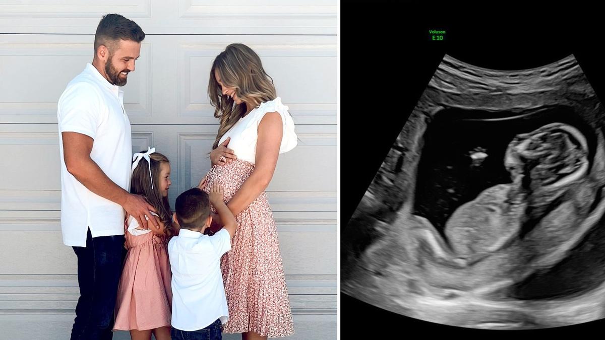 Pregnant Mom Decides to Keep Baby With Fatal Diagnosis, Says ‘God Trusted Me to Carry This Angel’