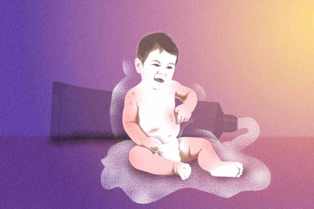 Clear Skin or Risk? The Steroid Dilemma for Eczema