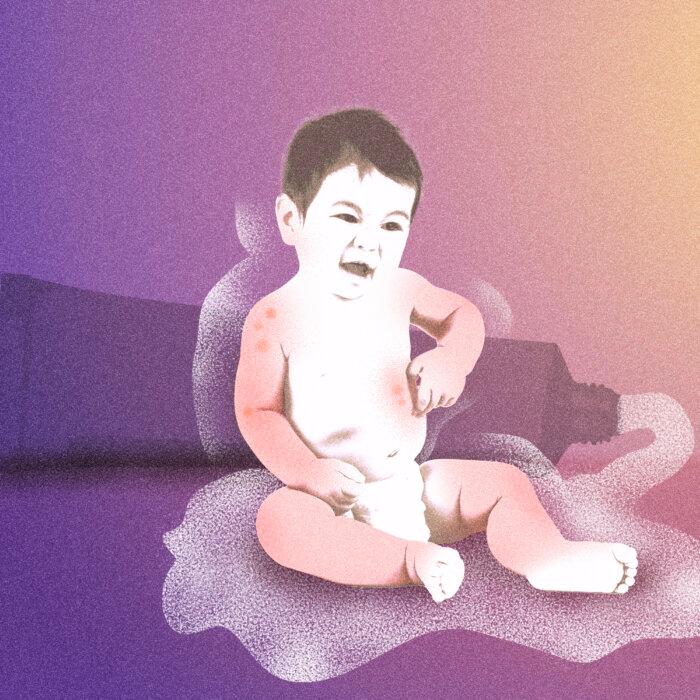 Clear Skin or Risk? The Steroid Dilemma for Eczema