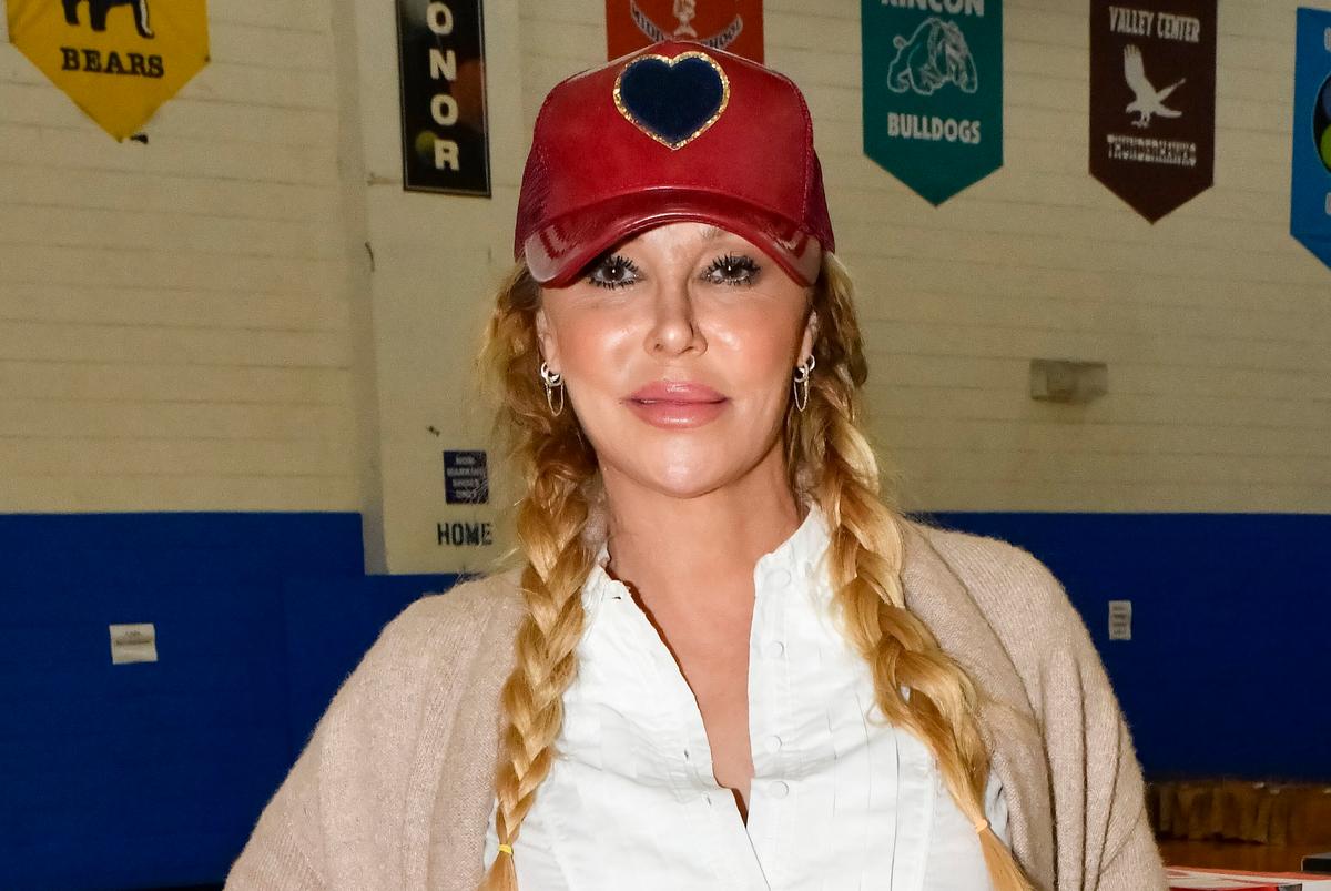 Reality TV Star Brandi Glanville Hospitalized Amid Battle With Facial Disfigurement