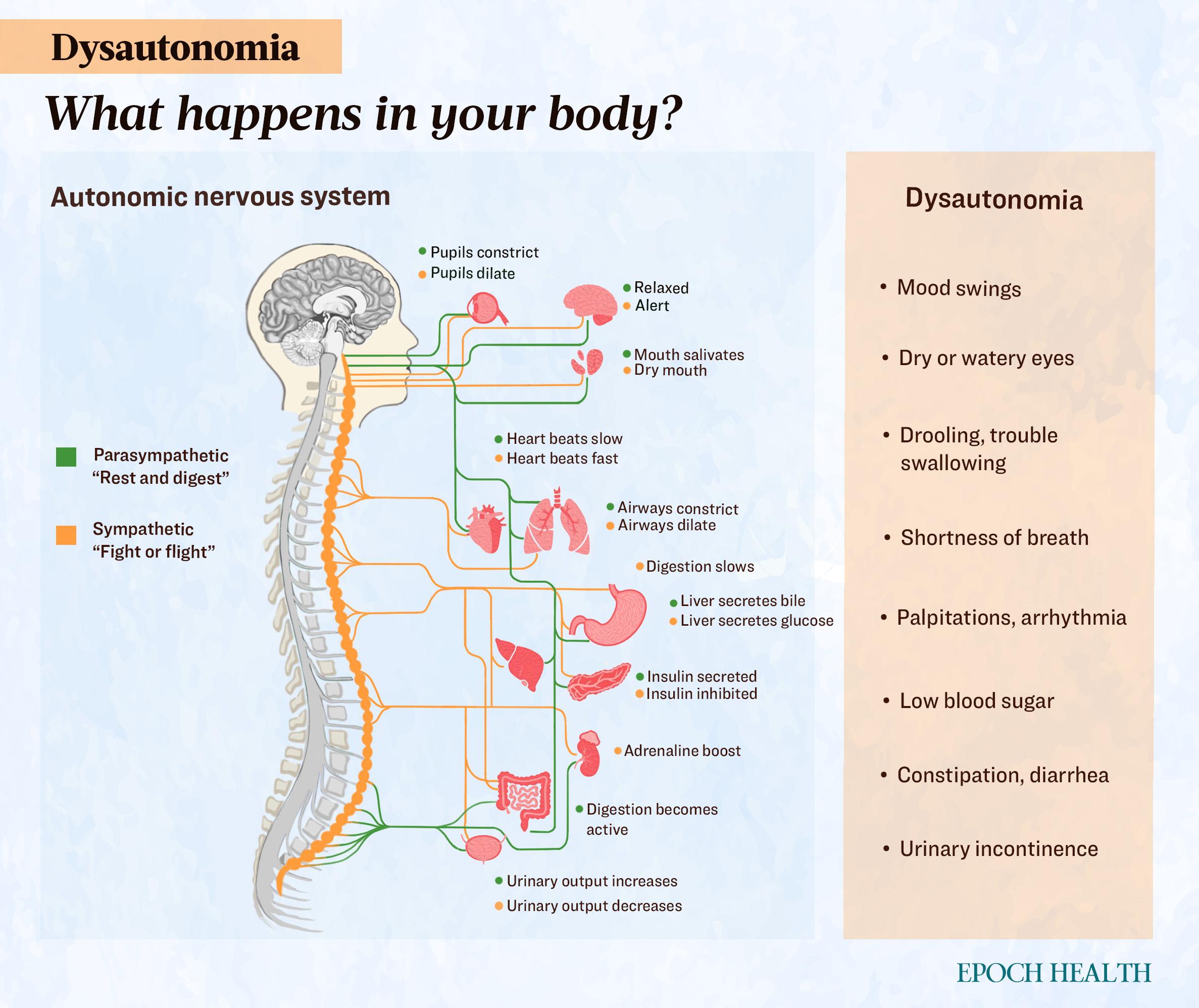 Dysautonomia: Symptoms, Causes, Treatments, and Natural Approaches | USNN World News image-5790564