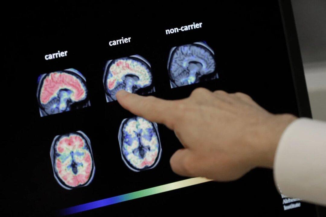 Americans’ Dementia Cases Forecast to Double by 2060, Study Finds
