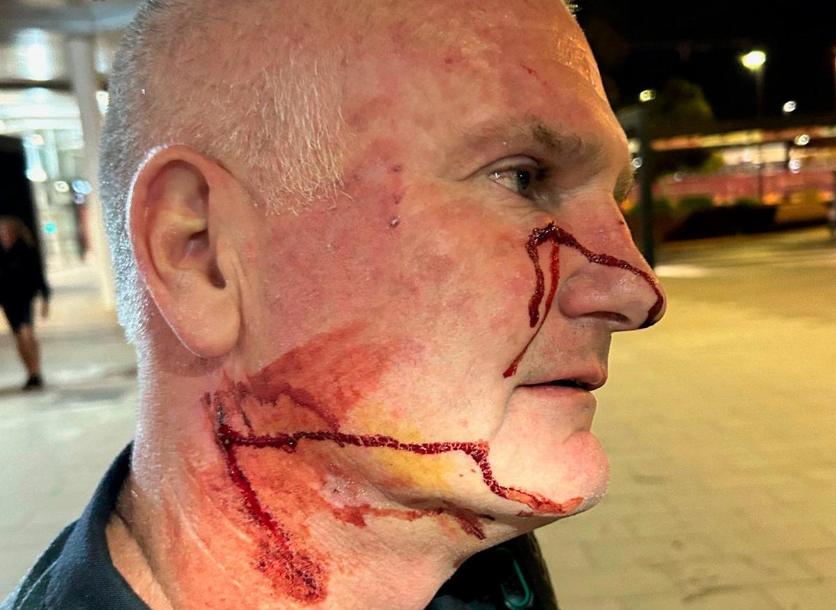 Woman Arrested After Allegedly Stabbing Officer in the Face With Pen