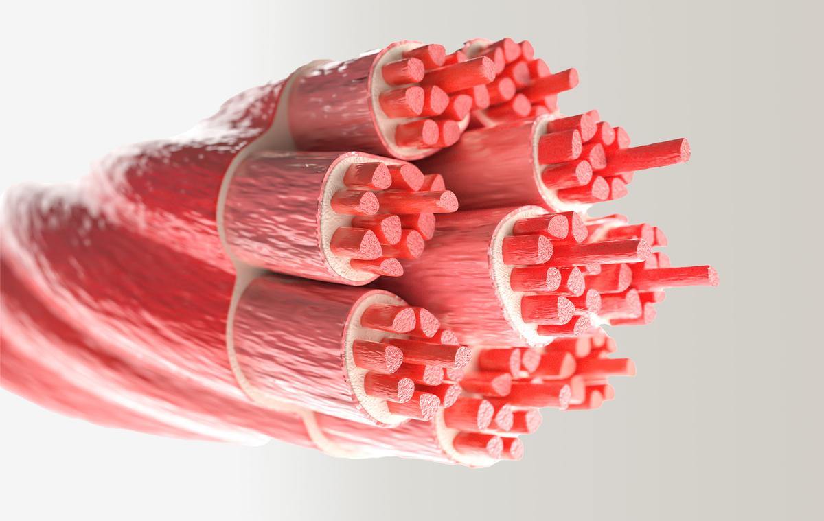 Fat Within Muscles More Dangerous for Heart Than Overall Body Weight