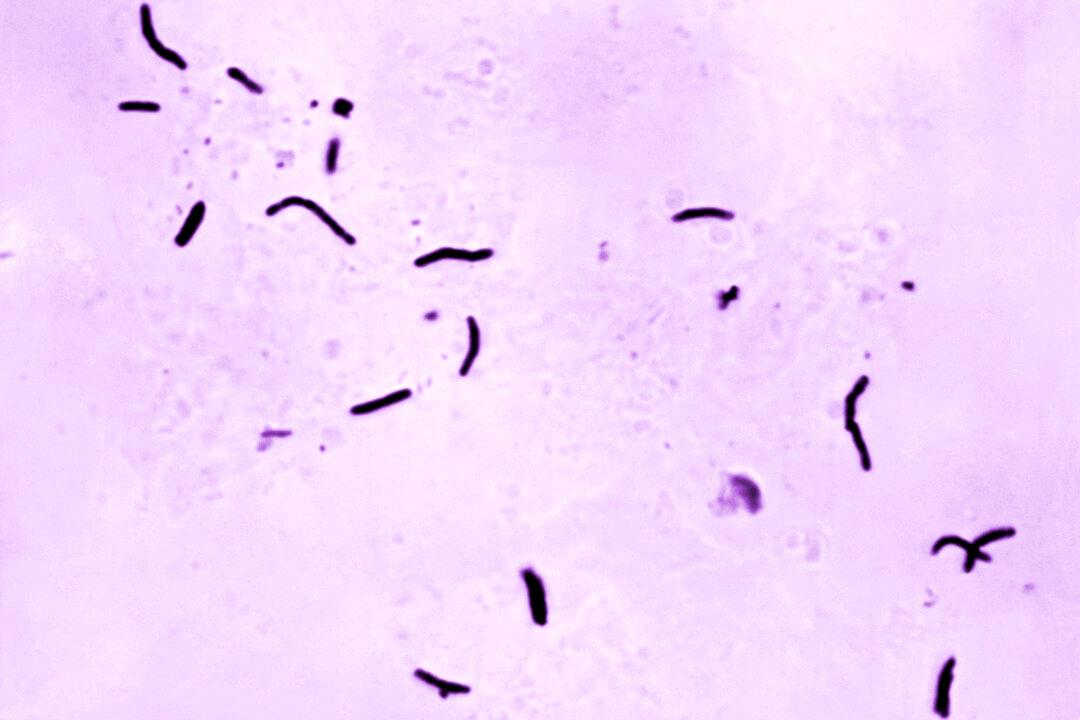 2 Dead, Dozens Sick in Tuberculosis Outbreak in Kansas City Area