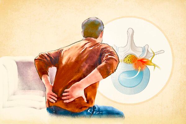 Herniated Disk: Symptoms, Causes, Treatments, and Natural Approaches